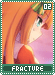 fracture02 fracture02.gif